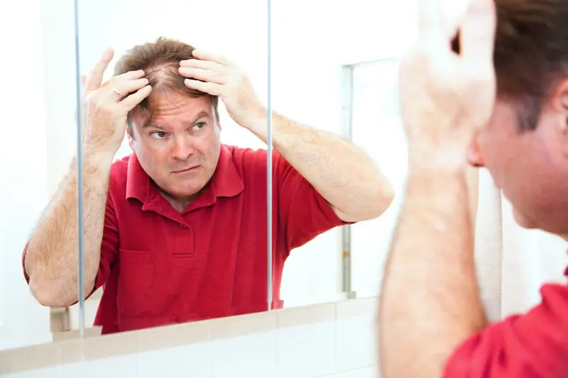 Hair loss in men