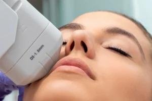 Cryo Hifu Behandlung