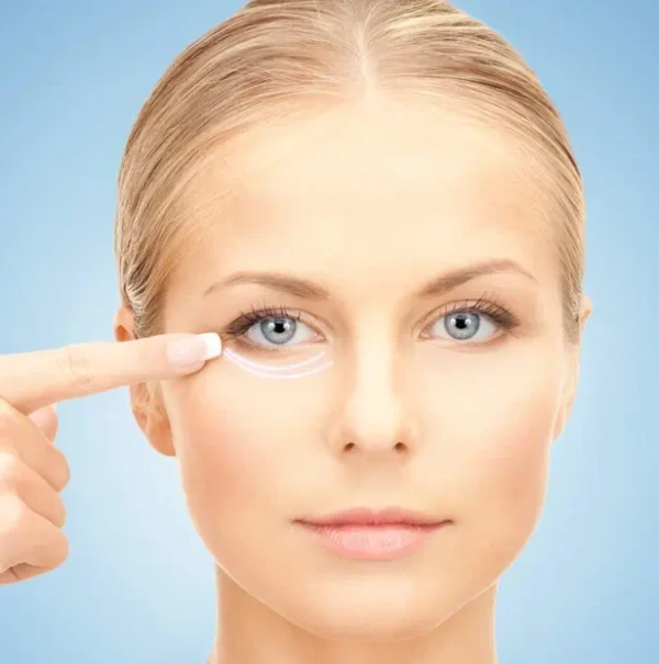 Eyelid lift without surgery